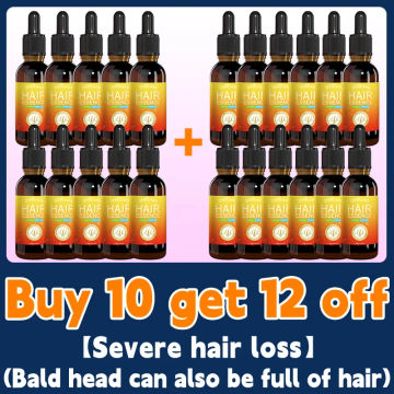It only takes 7 days to repair baldness. Hair growth essential oil can effectively repair baldness.