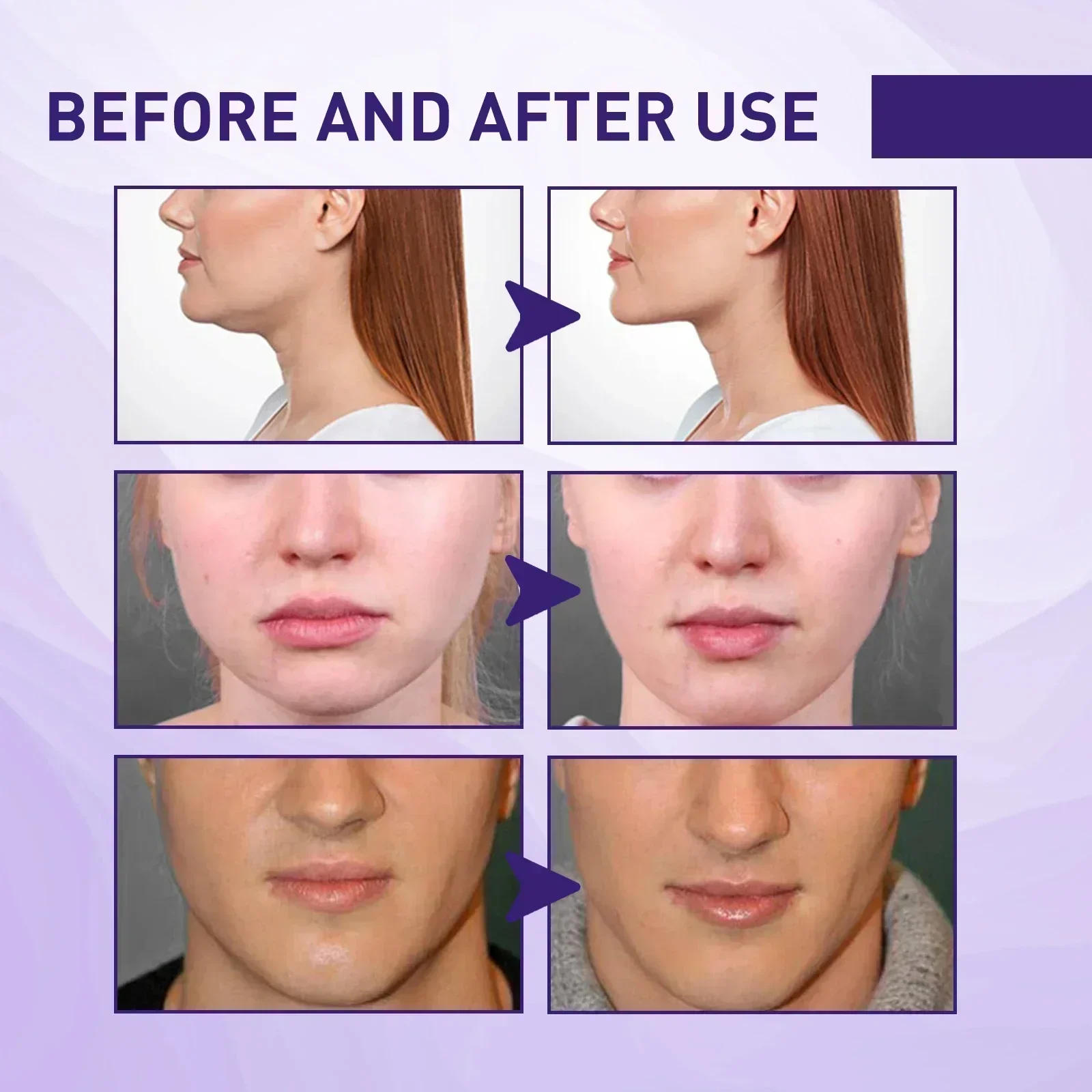 Description Picture 3 of itemMake your face elegant and your lines smooth