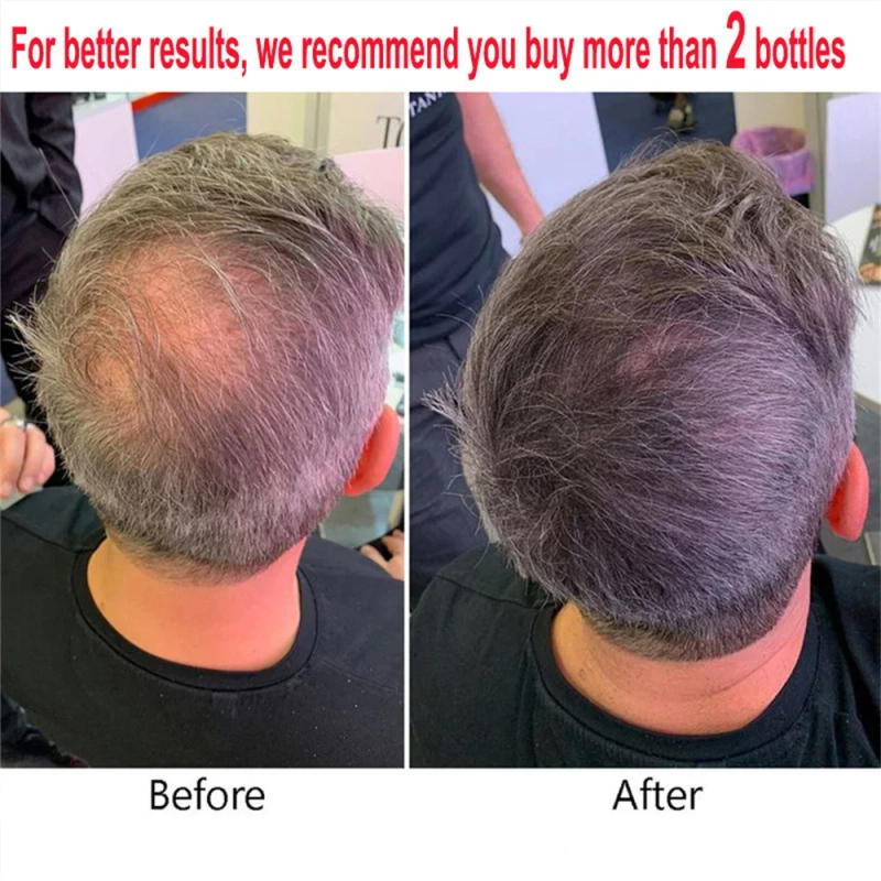 Description Picture 2 of itemFast Hair Growth Essential Oil Anti Hair Loss Treatment Prevent Thinning Repair Nourish Hair Roots Hair Care Serum For Men Women