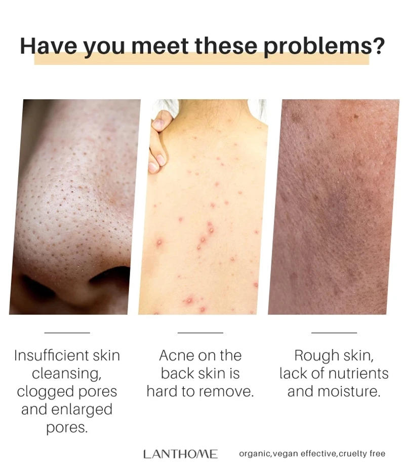 Description Picture 5 of item2Pcs Turmeric Soap Face Cleansing Anti Acne Whitening Skin Lightening Face Remove Pimples Dark Spots Lightening Handmade Soap