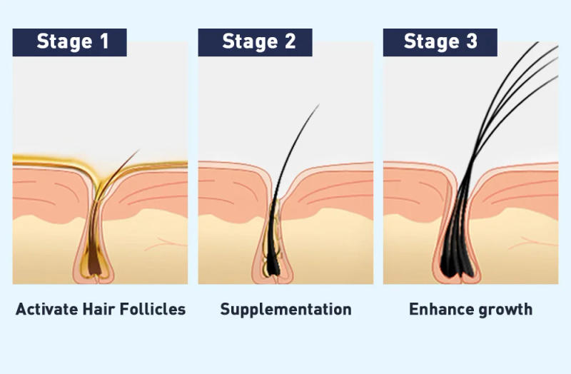 Description Picture 5 of itemEyebrow Eyelash Growth Serum Fast Growing Prevent Hair Loss Damaged Treatment Prevent Baldness Fuller Thicker Eye Care Makeup