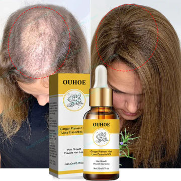 Fast Hair Growth Ginger Growth Hair Oil Treatment Anti Hair Loss Men Women Scalp Treatment Serum Products Beauty Health