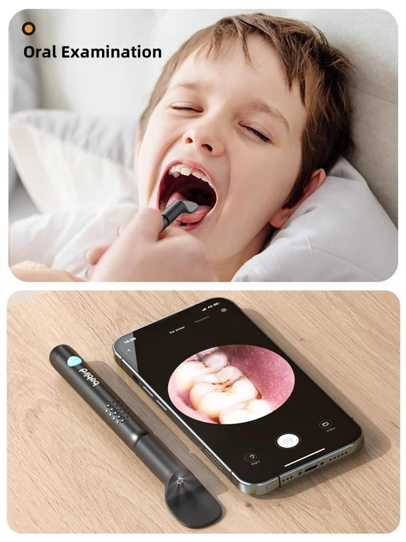 Description Picture 3 of itemBebird Ear Cleaner Ultra Minifit Ear Wax Removal Tool Mini Nose Mouse Examine HD Camera Earpick Otoscope Personal Health Care