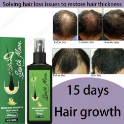 Fast hair growth promoter products Hair loss Hereditary Seborrheic alopecia treatment oil For Hair growth essence Natural safety