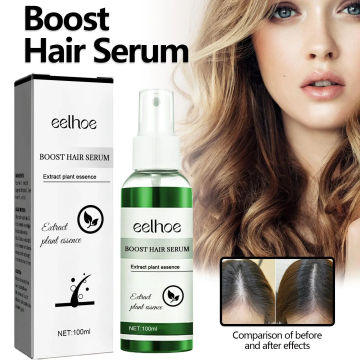 Sdotter Eelhoe Rosemary Herbal Hair Care Essence Anti-Drop Solid Hair Strong Hairs Supple Hairs Care Dense Hairs Liquid Hair Gro