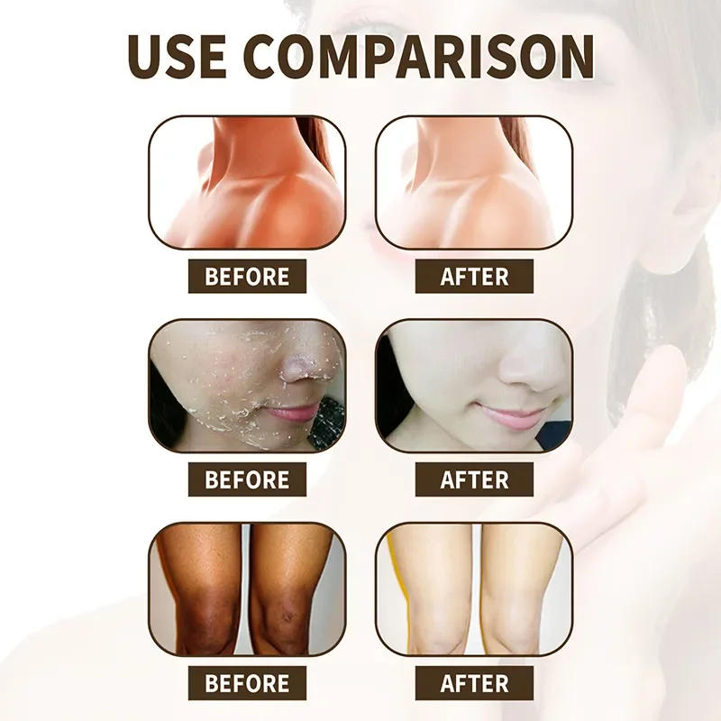 Description Picture 6 of itemCoffee Body Scrub Cream Exfoliating Bleach Elbow Underarm Knee Melanin Pigmentation Whitening Remove Dead Skin Shower Scrub Care