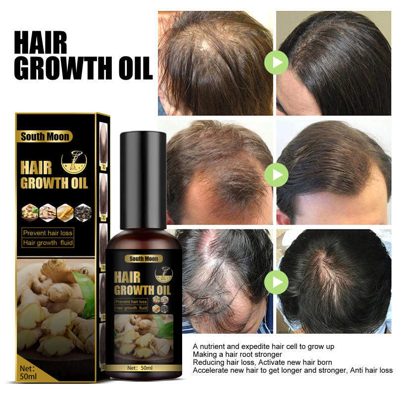 Description Picture 3 of itemHair Growth Essential Oils Repair Damaged Hair Anti Hair Loss Prevent Hair Loss Oil Ginger Fast Growing Hair Essential Oil