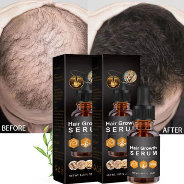 Hair Growth Essential Oil Women Fast Hair Growth Hairs Oil Men Efficient Prevent Hair Loss Serum Scalp Treatment Beard Growth