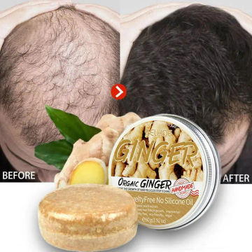 Ginger Hair Growth Soap Fast Growing Anti Hair Loss Products Treatment Hair Dry Frizzy Damaged Repair Beauty Health Men Women