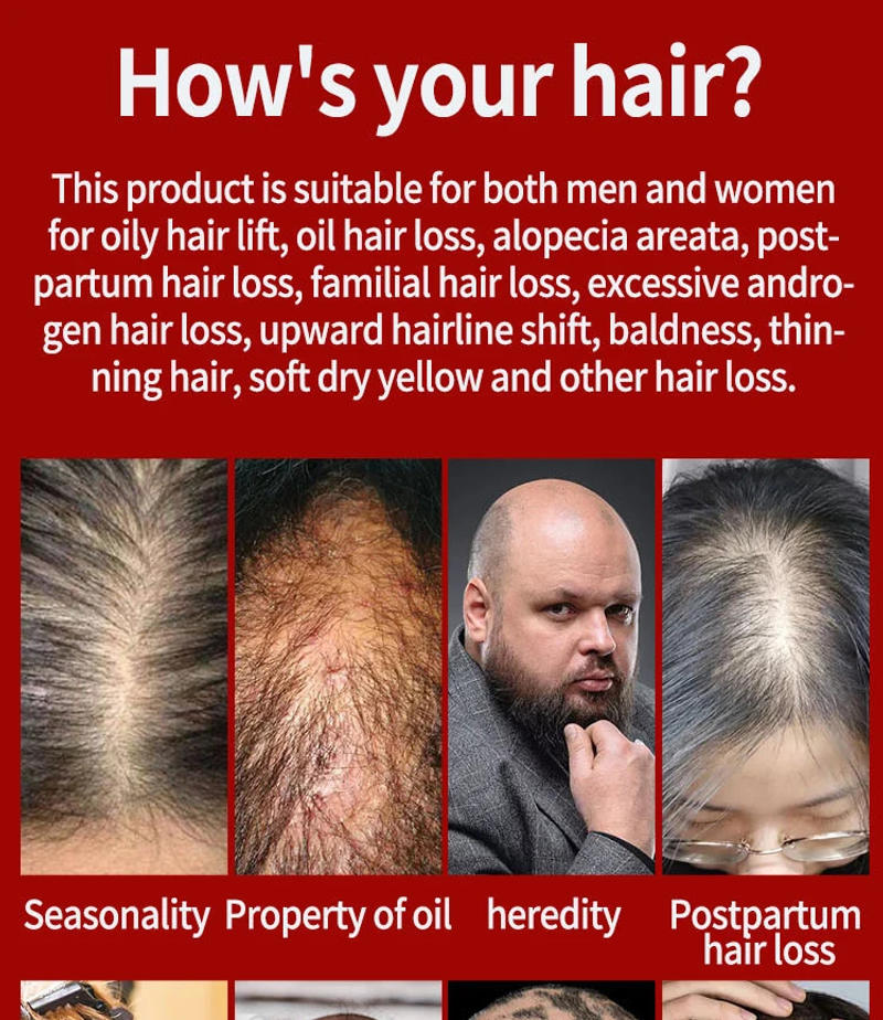 Description Picture 5 of item2023 Biotin Fast Hair Growth Oil Hair Regrowth Serum Hair Thinning Treatment Hair Growth Liquid Anti-Hair Loss for Women Men