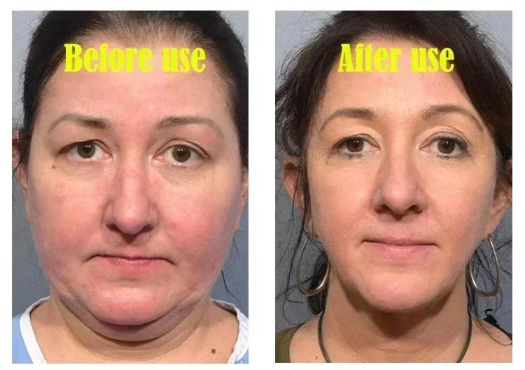 Description Picture 4 of itemEffective V-Shape Face Slimming Lifting Facial Cream Lift Up V Double Chin Cheek Slimming Firming Anti Wrinkle Beauty Skin Care