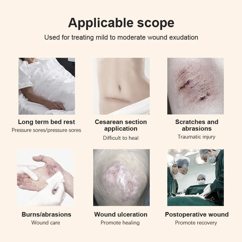 Description Picture 6 of item5PC Portable Hydrocolloid Adhesive Dressing Wound Dressing Self Adhesive Breathable Ultra Thin Waterproof Bedsore Heal Pad Patch