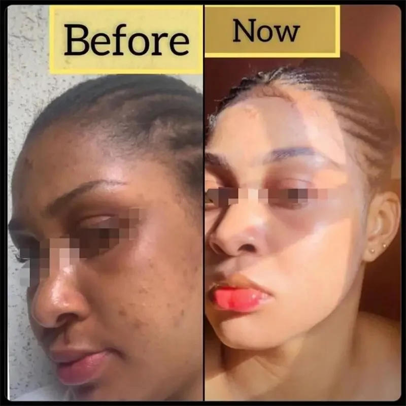 Description Picture 2 of itemBody Whitening Soap Deep Clean Skin Chicken Skin Removal Soap Armpit Underarm Knees Bleaching Body Brighten White Care New