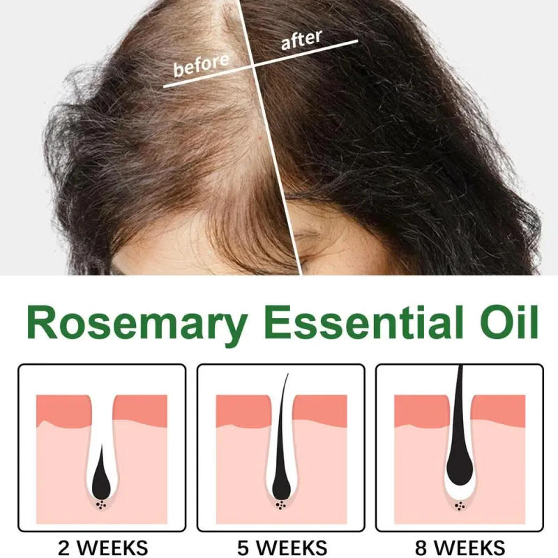 Description Picture 5 of itemSdatter Rosemary Hair Oil Natural Scalp Hair Strengthening Oil Nourishing Oil Premium Enhanced Organic Rosemary Oils Serums For