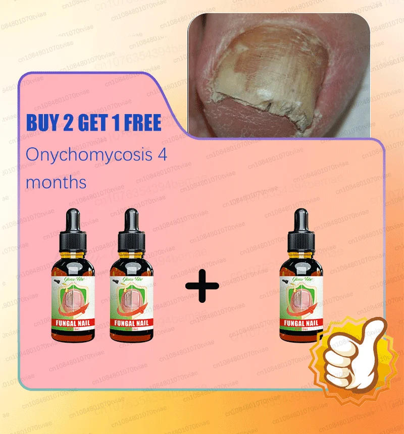 Description Picture 5 of itemEliminate nail problems