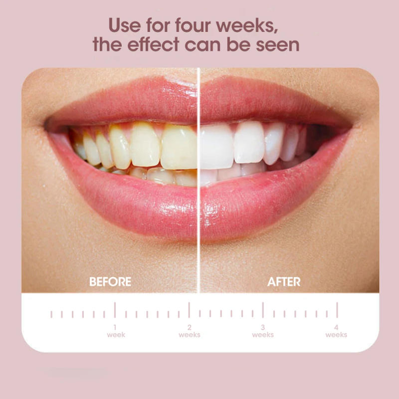 Description Picture 5 of itemElectric Sonic Toothbrush USB Charge Rechargeable Adult IPX7  Waterproof Electronic Tooth 4 Brushes Replacement Heads Whitening