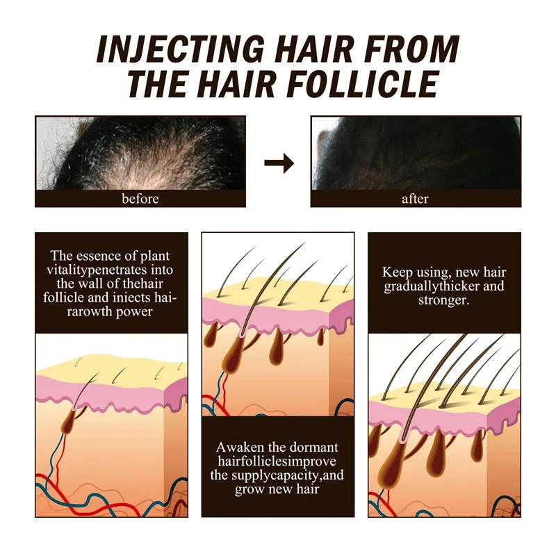 Description Picture 5 of itemPowerful Hair Growth Serum Spray Ginger Anti Hair Loss Treatment Repair Nourish Hair Roots Fast Regrowth Hair Men Women Products