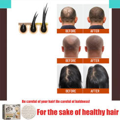 Anti Dropping, Nourishing, Firming,For the sake of hair , Protecting the scalp.Protecting the scalp and Nourishing Hair Roots