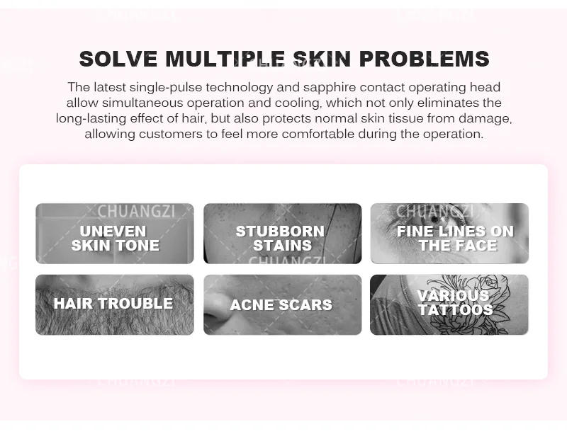 Description Picture 5 of itemProfessional IPL+ OPT Epilator Laser Painless Hair Removal Machine E-Light Skin Whitening Fast Depilation Permanent Device