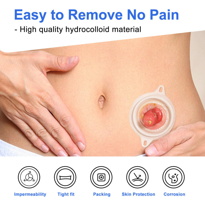 Description Picture 4 of item10PCS Ostomy Barrier Rings-Outer Diameter: 2" (50mm) 2mm Thickness Compatible with All Bag Types and Brands