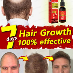 Hair Growth Oil Fast Hair Growth Effective Baldness Repair Hereditary Hair Loss Postpartum Hair Loss Seborrheic Hair Loss