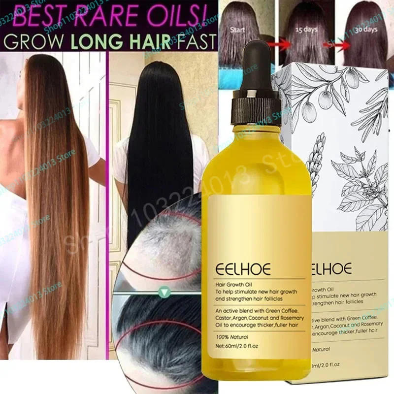 Description Picture 3 of itemFast hair growth promoter products Hair loss Hereditary Seborrheic alopecia treatment oil For Hair growth essence Natural safety