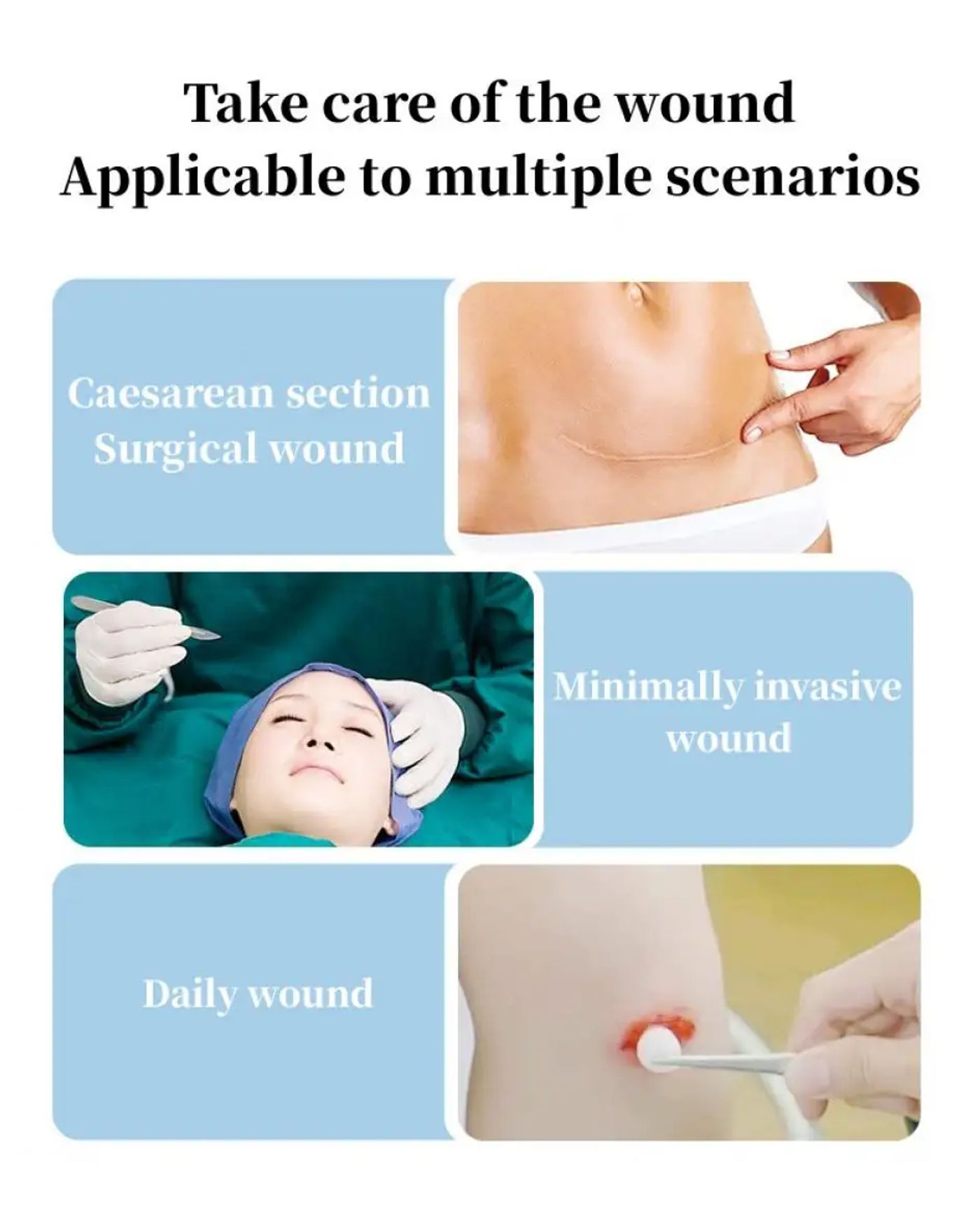 Description Picture 3 of itemSeam-Free Tape Medical Pull-Free Seam-Free Tape Wound Wound Suture Closed Dressing Breathable Skin Repair