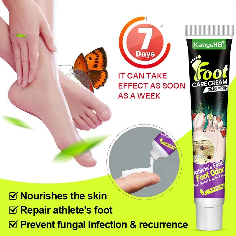 Description Picture 4 of item네일 Foot Care Tools KanyeHB Foot Ointment Feet Odor Care Cream Feet Skin Topical Cream Masajeador De Pies علاج الاسترخاء