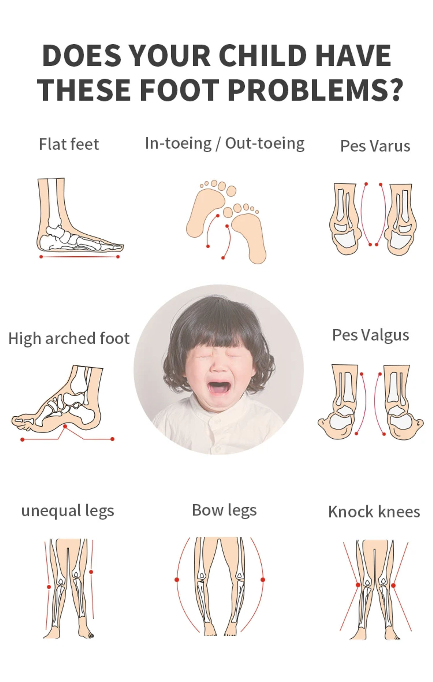 Description Picture 4 of itemAutumn Children Orthopedic Shoes, Blue Kids Sport Sneakers with Corrective Insole Collocate AFOs Tip Toe Walking Arch Support