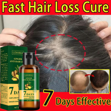 Ginger Hair Growth Product Anti-loss Hair Regrowth Serum Oil Fast Grow Prevent Baldness Treatment Alopecia Men Women Hair Care