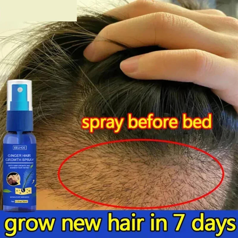 Description Picture 2 of itemHair Growth Spray Fast  Hair Growth Treatment Baldness Promote Thicker Longer Moisturize Anti Hair Loss Care Ginger Spray 30ML