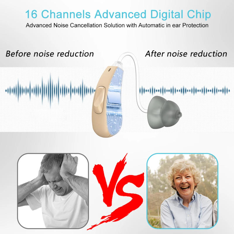Description Picture 6 of item16 Channels Hearing Aid For Deafness Rechargeable Hearing Aids Digital Invisible Sound Amplifier with Noise Cancelling Audifonos