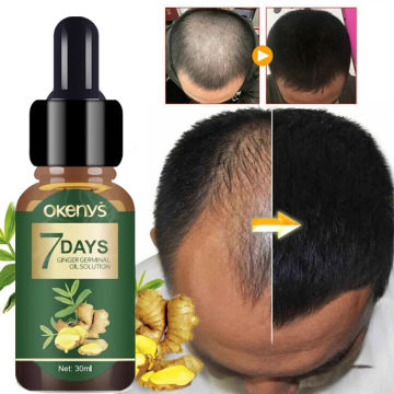 Ginger Oil Hair Growth for Men Women Fast Growing Products Essential Oils Ginger Anti Hair Loss Scalp Treatment Hair Care