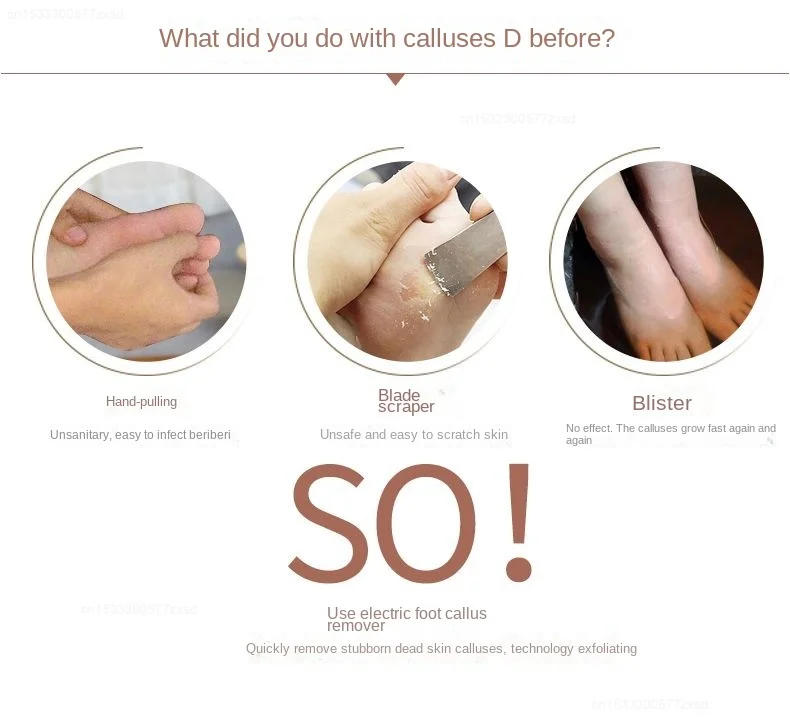 Description Picture 4 of itemXiaomi Pritech Rechargeable Foot Sharpener Care for Dead Skin Household Safe quickly Foot Care waterproof Foot Therapy Machine