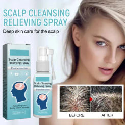 Scalp Treatment Spray for Hair for Men Women Anti Dandruff Anti Itch Loss Essence Oil Smoothing Hair Care 30Ml