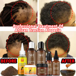 Africa Women Traction Alopecia Treatment Hair Growth Product for Men Chebe Powder Shampoo Anti-Hair Loss Spray Get Rid of Wigs