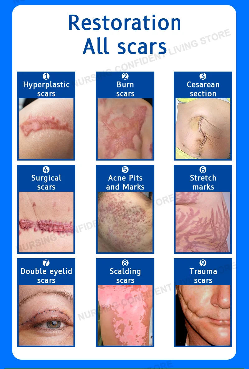 Description Picture 6 of itemDeep scar healing Scar gel for all new and old scars