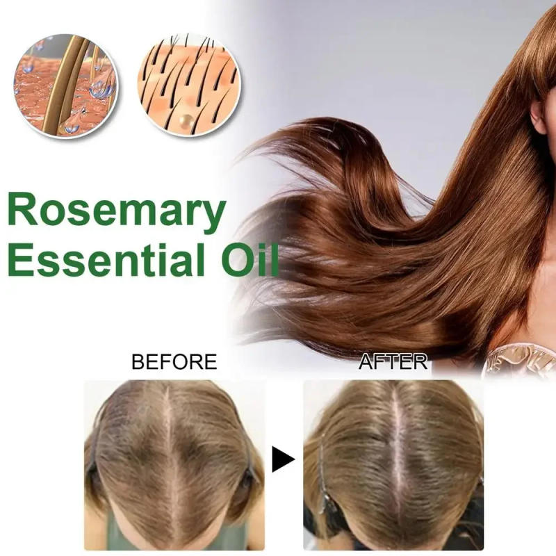 Description Picture 6 of itemSdatter Rosemary Hair Oil Natural Scalp Hair Strengthening Oil Nourishing Oil Premium Enhanced Organic Rosemary Oils Serums For