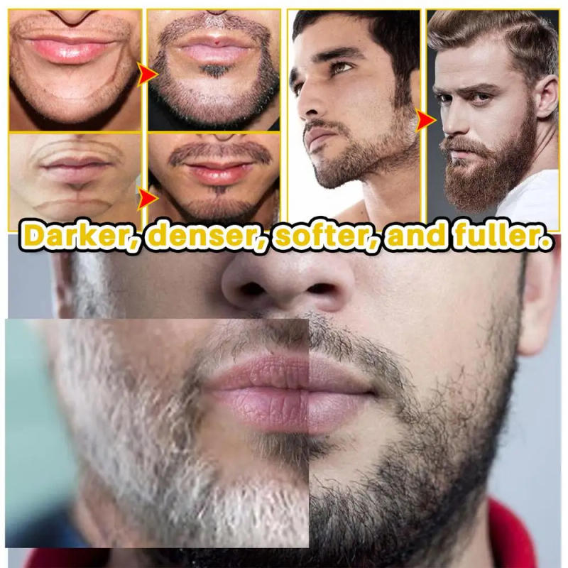 Description Picture 6 of item30ml Beard Growth Spray Beard Growth Serum Hair Growth Essentiall Oil Anti Hair Loss Prevent Baldness Treatments Beard Care