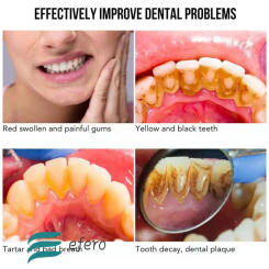 Ultrasonic Calculus Remover Teeth Plaque Scaler Tartar Eliminator Stains Cleaner Electric Tooth Stone Remover