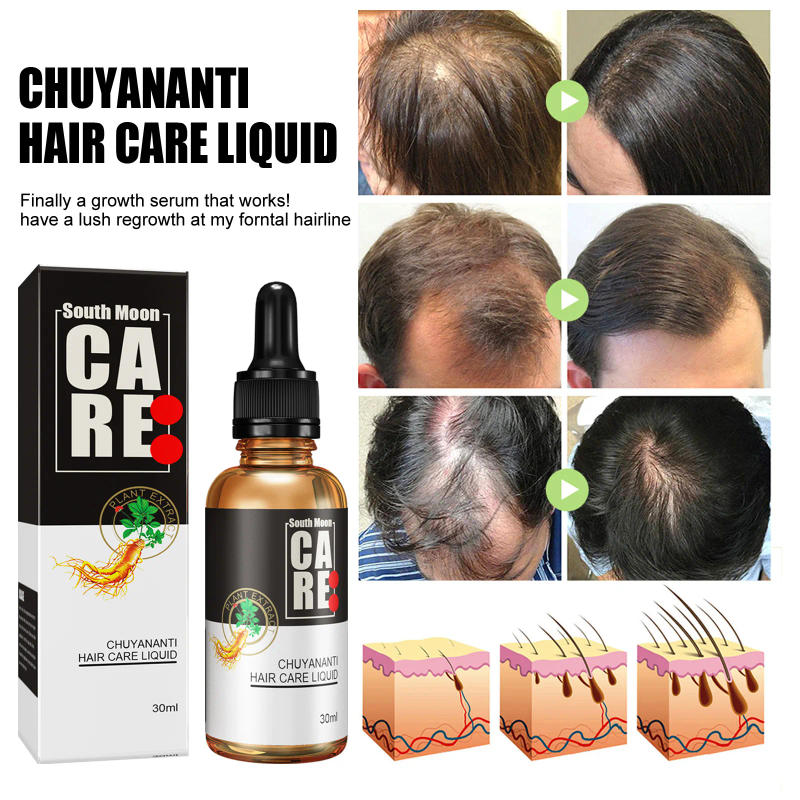 Description Picture 6 of itemAnti hair loss and hair growth liquid for hair growth, dense hair, and hair fixing herbal plant extract hair essence
