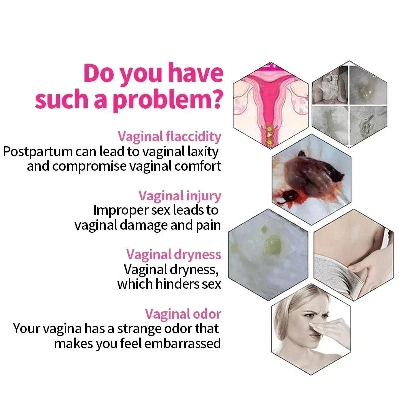 Description Picture 2 of itemNatural Vaginal Tightening Spray Feminine Hygiene Products And Vagina Narrow Shrinking Gynecological Cream Privates Care 30Ml