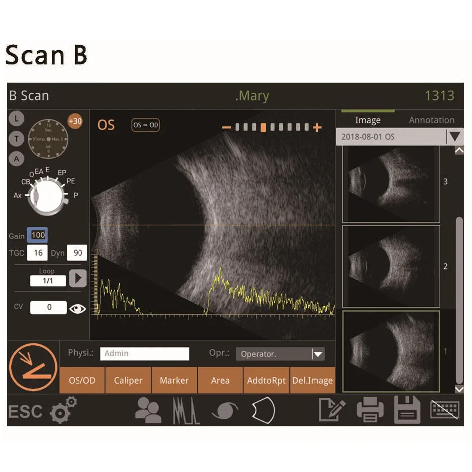 Description Picture 5 of itemAist Ophthalmic Ultrasound Scanner Optical A/B Scanner AB Scan Testing Equipment Ophthalmology Device Biometry Eye Scanner