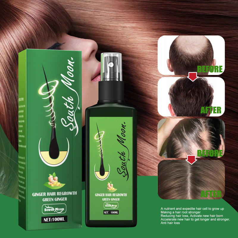Description Picture 4 of itemFast hair growth promoter products Hair loss Hereditary Seborrheic alopecia treatment oil For Hair growth essence Natural safety