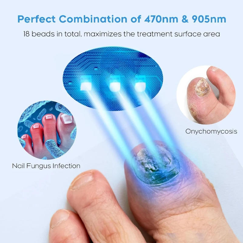 Description Picture 5 of itemNail Fungus Laser Treatment Device Repair Removes Toenail Fingernail Treatment Onychomycosis with Mushrooms Foot Care Tool