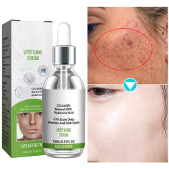 Freckles Removal Essence Remove Facial Spots Skin Dark Spot Remove Melasma Spots Sunspots Whitening And Freckle Removing oil