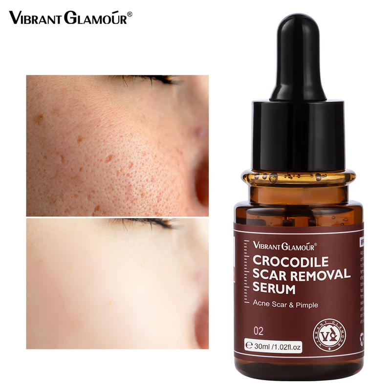 Description Picture 2 of itemCrocodile Scar Removal Serum 30ml