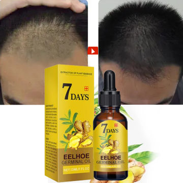 10/20/40ml Ginger Hair Growth Spray Essential Oils Loss Treatment Fast Grow Prevent Hair Dry Frizzy Damaged Thinning Repair Care