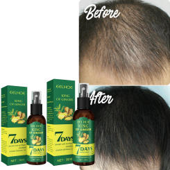 Ginger Hair Spray Strengthen Hair Anti-hair Loss Massage Scalp Soft and Smooth Improve Frizz Head Itch Damage Repair Essence