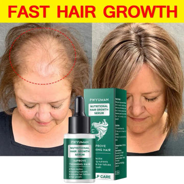 Fast Hair Growth Serum Anti-loss Hair Regrowth Thicken Essential Oil Prevent Baldness Treatment Nourish Scalp Hair Care Products